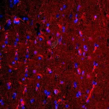 IHC-P analysis of human brain tissue using GTX37600 Lipocalin-2 antibody. Dilution : 1:200