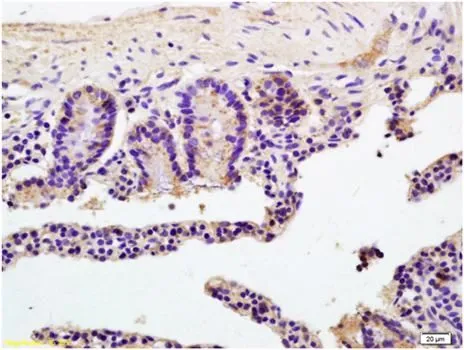 IHC-P analysis of mouse colon tissue using GTX37643 Sodium/Potassium ATPase beta 2 antibody. Fixation : 4% PFA Antigen retireval : boiling with citrate buffer Dilution : 1:200 IHC-P analysis of mouse colon tissue using GTX37643 Sodium/Potassium ATPase beta 2 antibody. Fixation : 4% PFA Antigen retireval : boiling with citrate buffer Dilution : 1:200