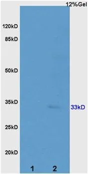 WB analysis of 30microg of rat kidney (Lane 1) and rat colon (Lane 2) tissue lysates using GTX37643 Sodium/Potassium ATPase beta 2 antibody.