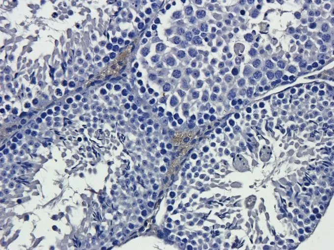 IHC-P analysis of mouse testis tissue using GTX37656 IL13 antibody. Dilution : 2.5microg/ml IHC-P analysis of mouse testis tissue using GTX37656 IL13 antibody. Dilution : 2.5microg/ml