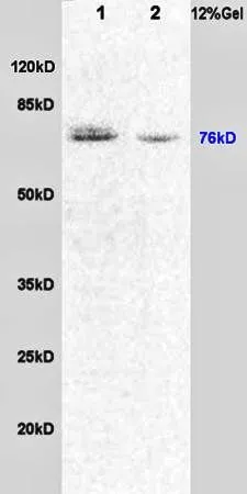 WB analysis of rat brain (Lane 1) and rat lung (Lane 2) tissue lysates using GTX37714 Dishevelled 1 antibody. WB analysis of rat brain (Lane 1) and rat lung (Lane 2) tissue lysates using GTX37714 Dishevelled 1 antibody.