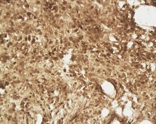 IHC-P analysis of human middle ear granulation tissue using GTX37716 beta 2 Defensin antibody.