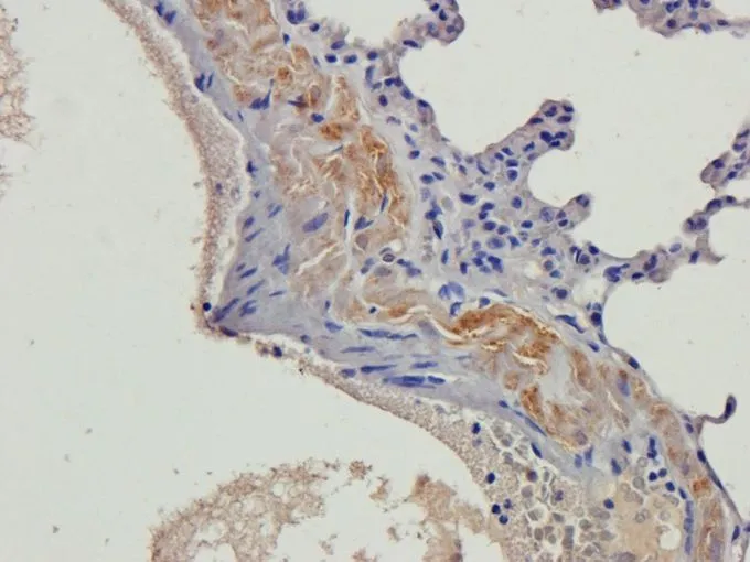 IHC-P analysis of rat lung tissue using GTX37717 beta 2 Defensin antibody. Dilution : 2.5microg/ml IHC-P analysis of rat lung tissue using GTX37717 beta 2 Defensin antibody. Dilution : 2.5microg/ml