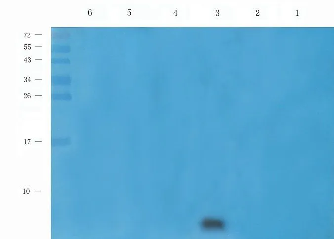 WB analysis of rat skin (Lane 1), rat trachea (Lane 2), mouse lung (Lane 3), rat kidney (Lane 4), mouse uterus (Lane 5), U251 (Lane 6) lysates using GTX37717 beta 2 Defensin antibody. Dilution : 1microg/ml