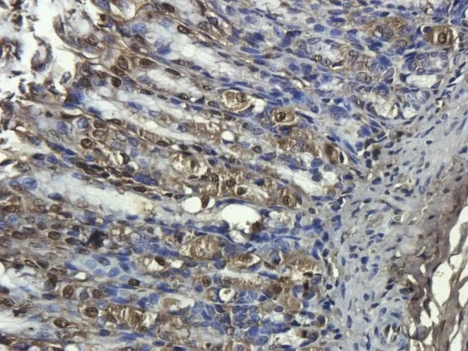 IHC-P analysis of rat stomach tissue using GTX37743 CD68 antibody. Dilution : 2.5microg/ml IHC-P analysis of rat stomach tissue using GTX37743 CD68 antibody. Dilution : 2.5microg/ml