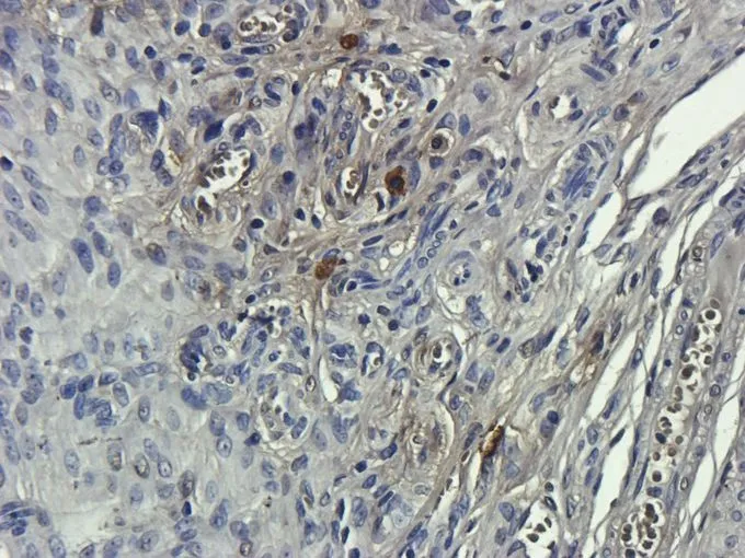 IHC-P analysis of mouse uterus tissue using GTX37743 CD68 antibody. Dilution : 2.5microg/ml