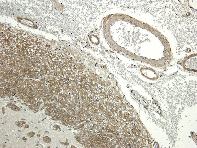 IHC-P analysis of rat brain tissue using GTX37784 Aquaporin 4 antibody. Dilution : 2.5microg/ml IHC-P analysis of rat brain tissue using GTX37784 Aquaporin 4 antibody. Dilution : 2.5microg/ml