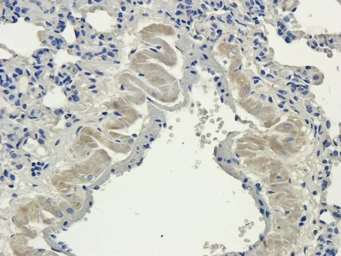 IHC-P analysis of rat lung tissue using GTX37784 Aquaporin 4 antibody. Dilution : 2.5microg/ml