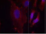 ICC/IF analysis of methanol-fixed HeLa cells using GTX38559 PLCG2 (phospho Tyr753) antibody. ICC/IF analysis of methanol-fixed HeLa cells using GTX38559 PLCG2 (phospho Tyr753) antibody.