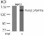 WB analysis of extracts of HepG2 cells treated or untreated with EGF using GTX38559 PLCG2 (phospho Tyr753) antibody.