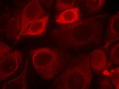 ICC/IF analysis of MCF-7 cells using GTX38571 Her3 / ErbB3 (phospho Tyr1328) antibody. ICC/IF analysis of MCF-7 cells using GTX38571 Her3 / ErbB3 (phospho Tyr1328) antibody.