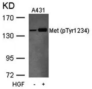 WB analysis of extracts of A431 cells untreated or treated with HGF using GTX38574 c-Met (phospho Tyr1234) antibody. WB analysis of extracts of A431 cells untreated or treated with HGF using GTX38574 c-Met (phospho Tyr1234) antibody.
