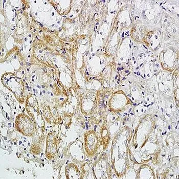 IHC-P analysis of mouse kidney tissue using GTX38577 VEGF Receptor 2 (phospho Tyr1175) antibody. Dilution : 1:200 IHC-P analysis of mouse kidney tissue using GTX38577 VEGF Receptor 2 (phospho Tyr1175) antibody. Dilution : 1:200