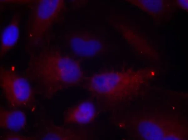 ICC/IF analysis of methanol-fixed HeLa cells using GTX38587 PAK1 ( phospho Thr423 ) / PAK2 ( phospho Thr402 ) / PAK3 ( phospho Thr436 ) antibody. Red : Primary antibody ICC/IF analysis of methanol-fixed HeLa cells using GTX38587 PAK1 ( phospho Thr423 ) / PAK2 ( phospho Thr402 ) / PAK3 ( phospho Thr436 ) antibody. Red : Primary antibody