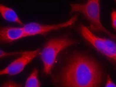 ICC/IF analysis of methanol-fixed HeLa cells using GTX38607 PKC mu (phospho Ser738) antibody. Red : Primary antibody ICC/IF analysis of methanol-fixed HeLa cells using GTX38607 PKC mu (phospho Ser738) antibody. Red : Primary antibody