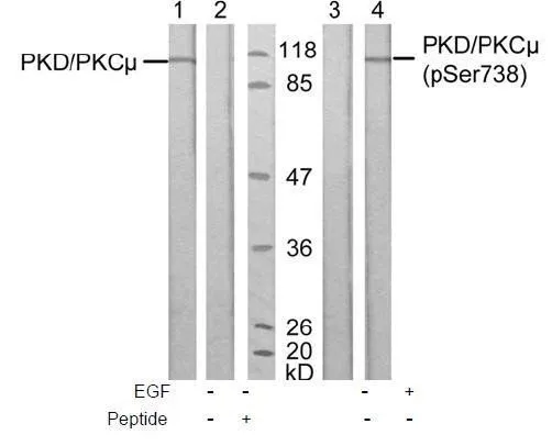 WB analysis of extracts of A431 cells untreated or treated with EGF (200ng/ml, 10min) using PKC mu antibody (Lane 1 and 2) and GTX38607 PKC mu (phospho Ser738) antibody(Lane 3 and 4).