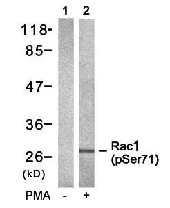 WB analysis of 293 cell lysate using GTX38610 Rac1 + CDC42 (phospho Ser71) antibody. WB analysis of 293 cell lysate using GTX38610 Rac1 + CDC42 (phospho Ser71) antibody.