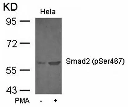 WB analysis of HeLa cell lysate using GTX38629 SMAD2 (phospho Ser467) antibody. WB analysis of HeLa cell lysate using GTX38629 SMAD2 (phospho Ser467) antibody.