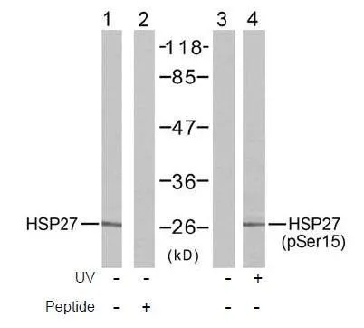WB analysis of HeLa cell lysate treated or untreated with UV using HSP27 antibody (Lane 1 and 2) and GTX38674 HSP27 (phospho Ser15) antibody (Lane 3 and 4).