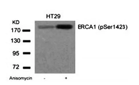 WB analysis of extracts of HT-29 cells untreated or treated with Anisomycin using GTX38676 BRCA1 (phospho Ser1423) antibody.
