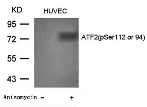 WB analysis of HUVEC cell lysate using GTX38683 ATF2 (phospho Ser112) antibody.