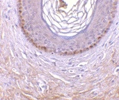 IHC-P analysis of human skin tissue using GTX38774 XEDAR antibody. IHC-P analysis of human skin tissue using GTX38774 XEDAR antibody.