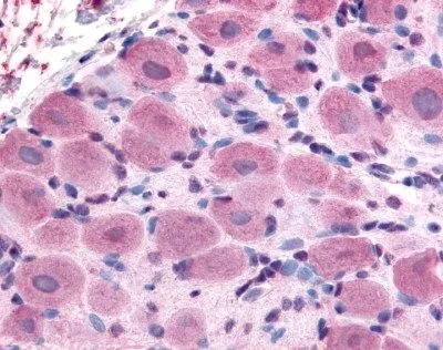 IHC analysis of human spinal cord dorsal root ganglion tissue using GTX38865 TRPA1 antibody. IHC analysis of human spinal cord dorsal root ganglion tissue using GTX38865 TRPA1 antibody.