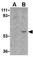 WB analysis of human lung tissue lysate using GTX38905 FAIM3 antibody, C-term. WB analysis of human lung tissue lysate using GTX38905 FAIM3 antibody, C-term.