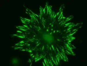 ICC/IF analysis of isolated talin-1 null cells using GTX38971 Talin-2 antibody. Cells were fixed in paraformaldehyde and permeablized with triton X-100. ICC/IF analysis of isolated talin-1 null cells using GTX38971 Talin-2 antibody. Cells were fixed in paraformaldehyde and permeablized with triton X-100.