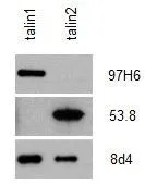 WB analysis of anti talin antibody binding to recombinant talin proteins showing specificity of Mouse anti Human talin-2 antibody, clone 53.8 (GTX38971) for talin-2, not recognizing recombinant human talin-1. In contrast Mouse anti talin-1 antibody, clone 97H6 (GTX38973) does not recognize recombinant human talin-2. Clone 8D4, recognizing both talin isoforms.