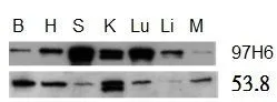WB analysis of talin-1 and talin-2 expression in murine tissue lysates using Mouse anti Human talin-2 antibody, clone 53.8 (GTX38971) and Mouse anti Human talin-1 antibody, clone 97H6 (GTX38973). (B) brain, (H) heart, (S) spleen, (K) kidney, (Lu) lung, Li (liver), (M) muscle.