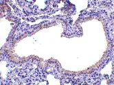IHC-P analysis of mouse lung tissue using GTX39074 SLPI antibody. Heat mediated antigen retrieval using citrate buffer pH6.0. IHC-P analysis of mouse lung tissue using GTX39074 SLPI antibody. Heat mediated antigen retrieval using citrate buffer pH6.0.