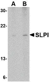 WB analysis of Daudi cell lysate using GTX39074 SLPI antibody at 1(A) and 2(B) ug/ml.