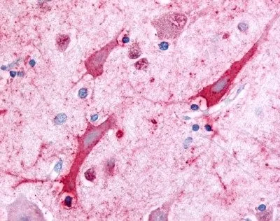 IHC-P analysis of human spinal cord tissue using GTX39077 SLC5A3 antibody, C-term. IHC-P analysis of human spinal cord tissue using GTX39077 SLC5A3 antibody, C-term.