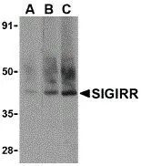 WB analysis of A549 cell lysate using GTX39096 SIGIRR antibody at (A)0.5, (B)1 and (C)2 ug/ml. WB analysis of A549 cell lysate using GTX39096 SIGIRR antibody at (A)0.5, (B)1 and (C)2 ug/ml.