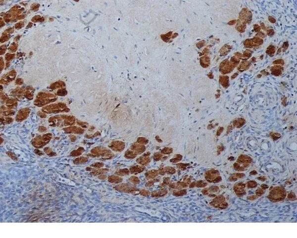 IHC-P analysis of human ovary tissue using GTX39285 Progesterone antibody [9B4].
