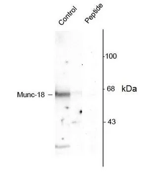 WB analysis of rat cortex tissue lysate using GTX39631 Munc18-1 (phospho Ser515) antibody. WB analysis of rat cortex tissue lysate using GTX39631 Munc18-1 (phospho Ser515) antibody.