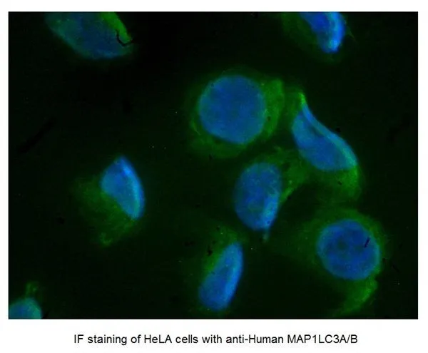 ICC/IF analysis of HeLa cells using GTX39752 LC3A/B antibody, N-term.