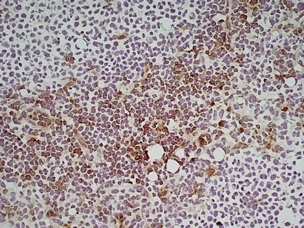 IHC-Fr analysis of mouse lymph node tissue using GTX39791 Ly-6C antibody [ER-MP20].