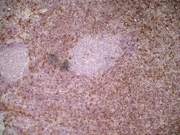 IHC-Fr analysis of mouse lymph node tissue using GTX39791 Ly-6C antibody [ER-MP20].