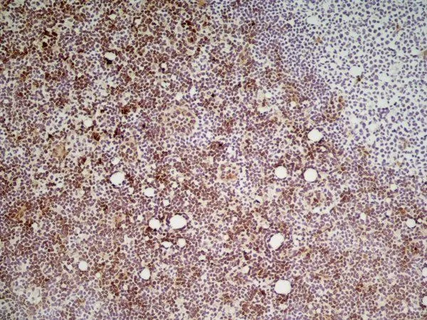 IHC-Fr analysis of mouse lymph node tissue using GTX39791 Ly-6C antibody [ER-MP20].