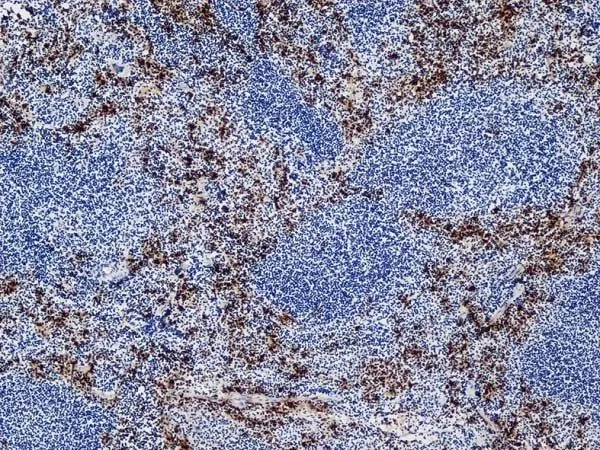 IHC-Fr analysis of C57BL/6 mouse spleen tissue using GTX39793 Ly-6B.2 antibody [7/4].