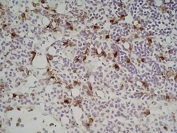 IHC-Fr analysis of mouse lymph node tissue using GTX39793 Ly-6B.2 antibody [7/4].