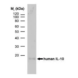 WB analysis of human IL-10 recombinant protein using GTX39969 IL10 antibody [JES3-9D7] (Low endotoxin,azide free).