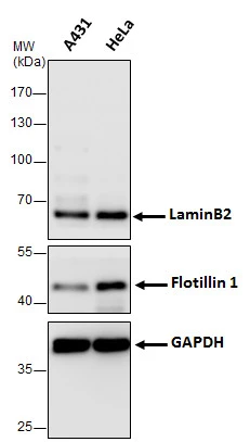 A431 and HeLa cells were lysed by using GTX400005 RIPA lysis buffer. Whole cell extracts (30 µg) were assayed by Western Blot analysis. The membrane was blotted with a cytosolic protein GAPDH antibody (GTX627408), a membrane protein Flotillin1 antibody (GTX104769) and a nuclear protein LaminB2 (GTX628803).