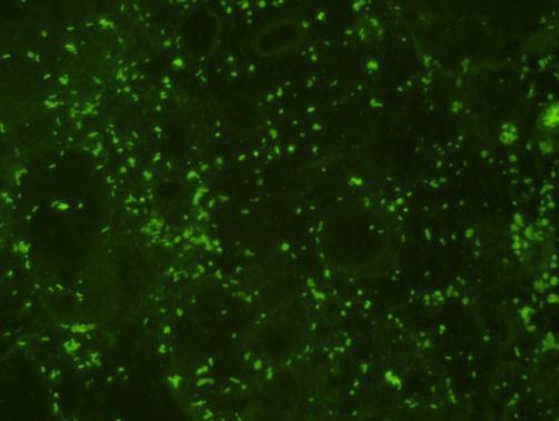 Immunofluorescent staining with GTX40001_Lipid-A.jpg.