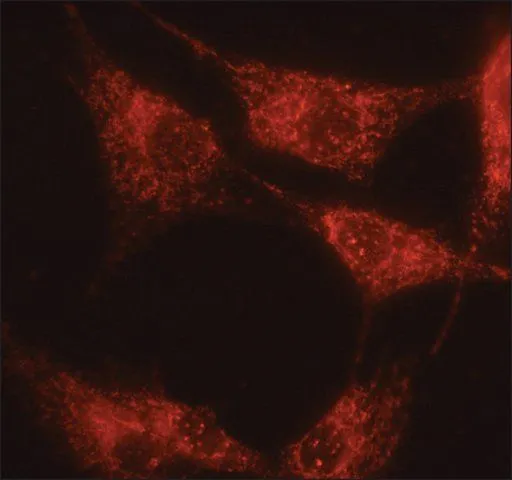 ICC/IF analysis of NRK cells using GTX40044 alpha 1,2 Mannosidase IA antibody at 10 microg/mL. Cells were fixed and permeabilized with cold methanol followed by cold methanol:acetone (1:1). ICC/IF analysis of NRK cells using GTX40044 alpha 1,2 Mannosidase IA antibody at 10 microg/mL. Cells were fixed and permeabilized with cold methanol followed by cold methanol:acetone (1:1).