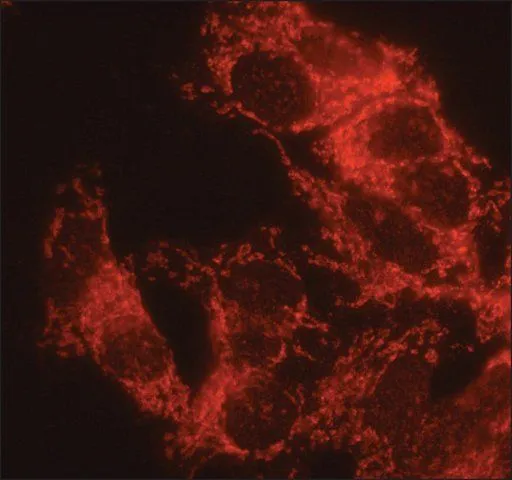 ICC/IF analysis of HepG2 cells using GTX40044 alpha 1,2 Mannosidase IA antibody at 10 microg/mL.Cells were fixed and permeabilized with cold methanol followed by cold methanol:acetone (1:1).