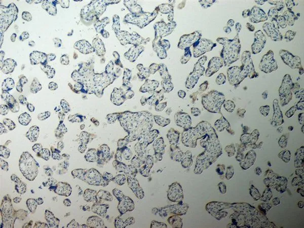 IHC-P analysis of human placenta tissue using GTX40215 Inhibin alpha antibody. Antigen retrieval using Tris/EDTA pH9.0. Blocking was with 0.3%H2O2 + 10% normal goat serum.