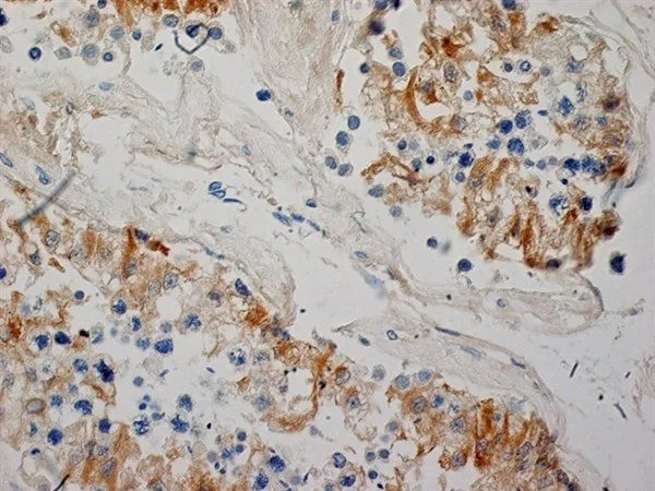 IHC-P analysis of human testis tissue using GTX40215 Inhibin alpha antibody. Antigen retrieval using Tris/EDTA pH9.0. Blocking was with peroxidase Blocking reagent + 10% normal goat serum.